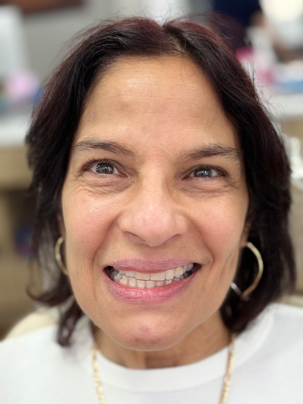 Adult patient smiling at the orthodontic office