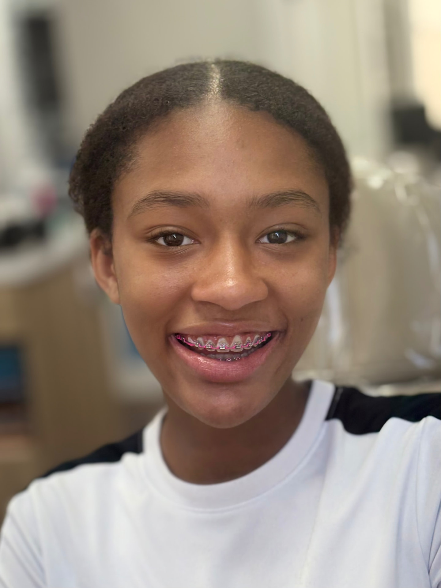 Close-up of a smile with braces