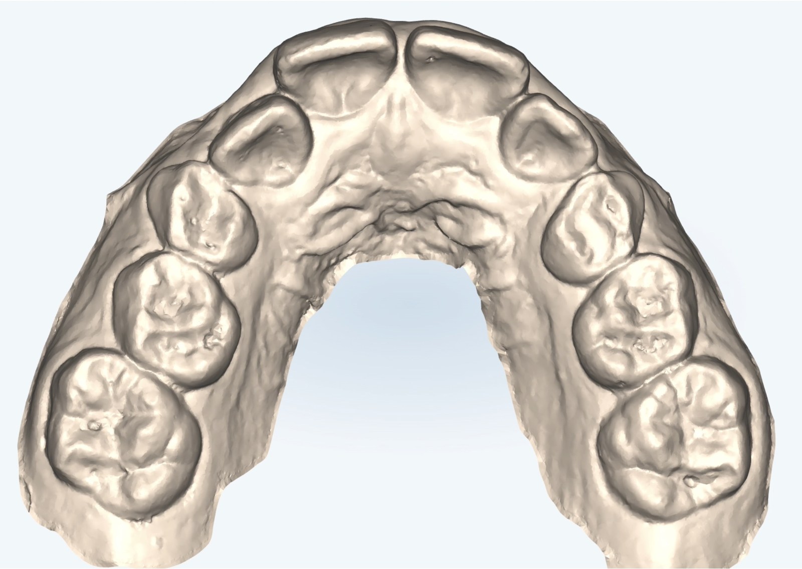 Three-dimensional digital model of a dental arch