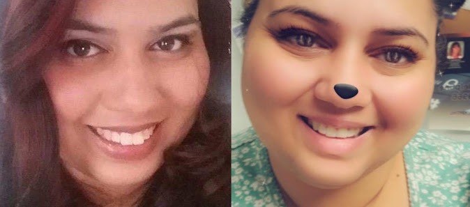 Side-by-side patient smile photographs before and after orthodontic treatment