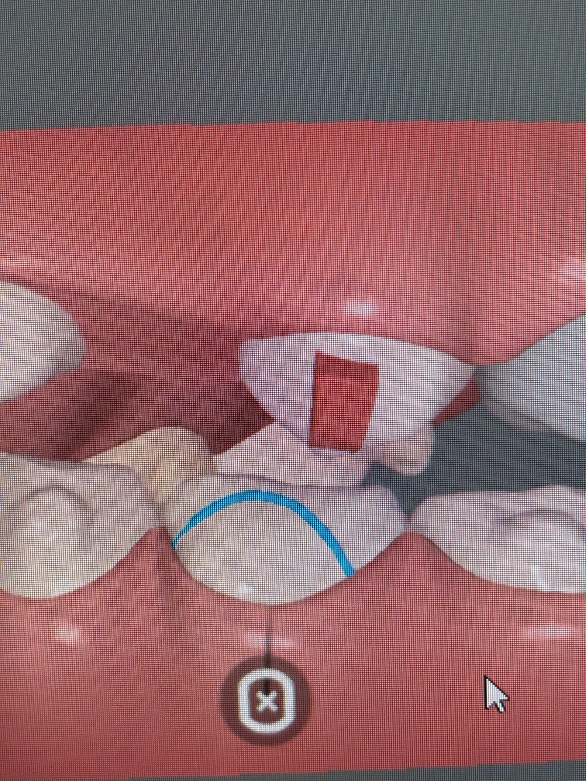 Close-up of a digital orthodontic bite model